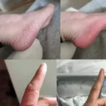 کرم ضد قارچ و ضد خشکی پا نانتونگ جون هوا