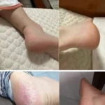 کرم ضد قارچ و ضد خشکی پا نانتونگ جون هوا